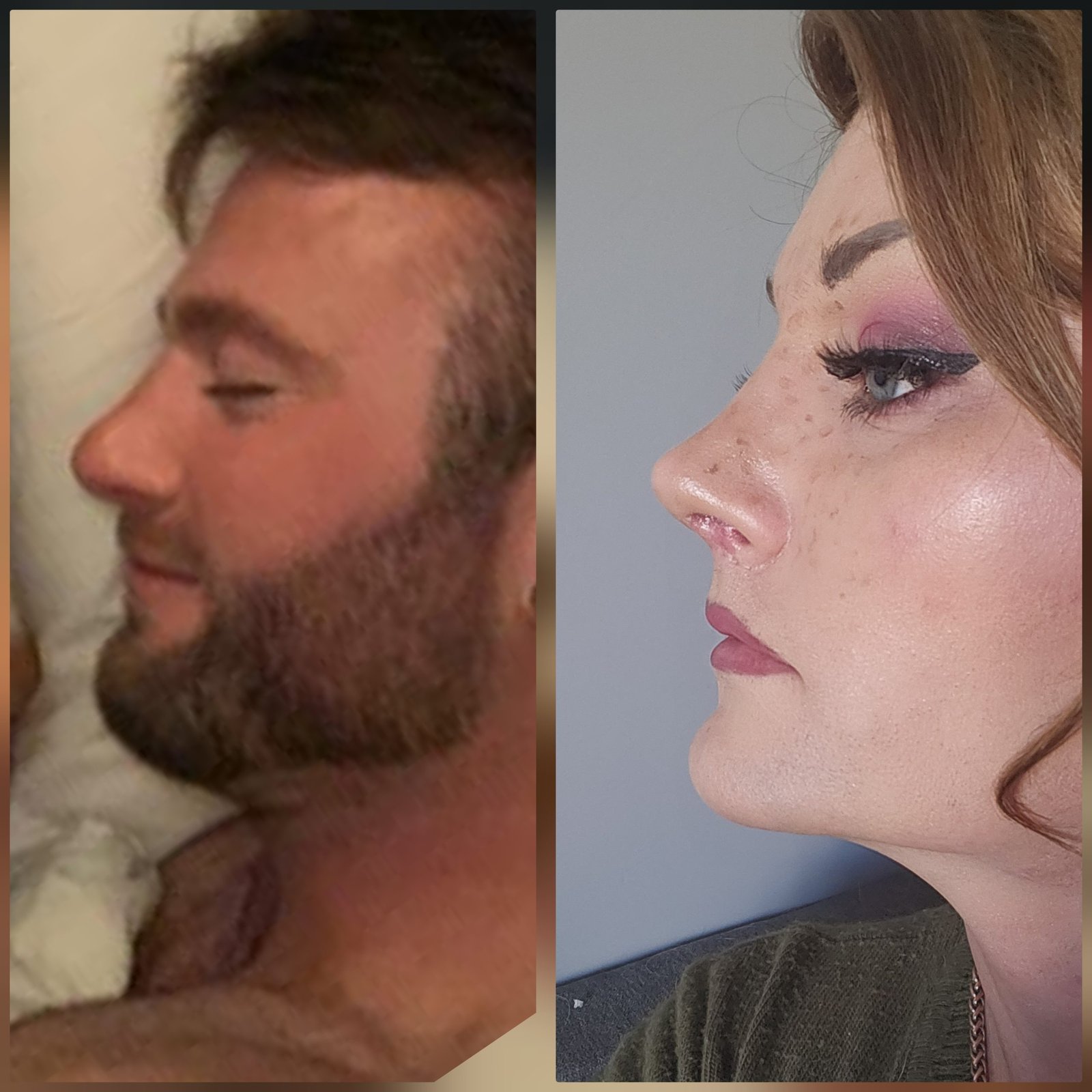 Transformation 1