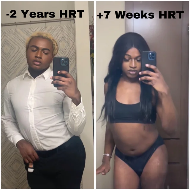 Transformation 17